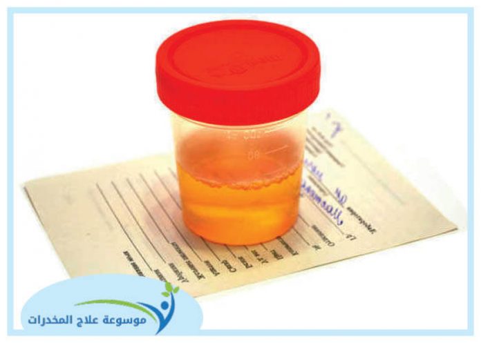 خطوات تحليل البول للمخدرات